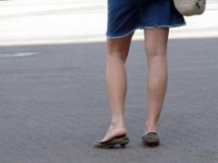 Boli ale venelor. Varice 1 Boli ale venelor. Varice 1